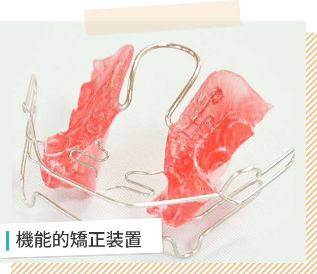 機能的矯正装置