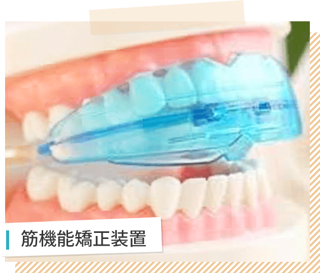 筋機能矯正装置