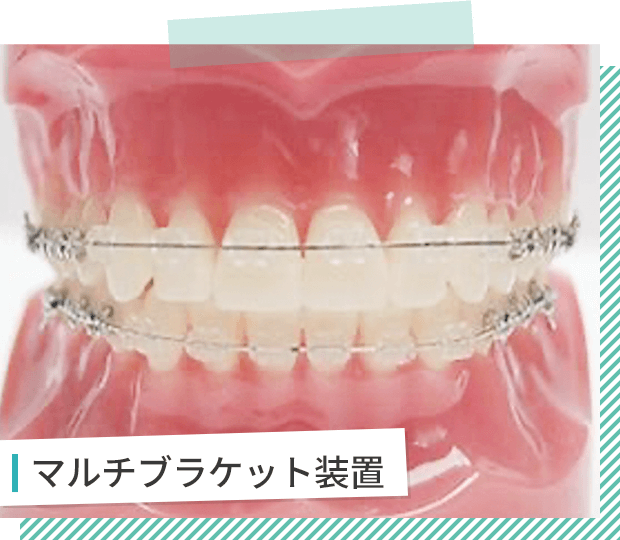 マルチブラケット装置